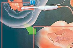 2026年灵宝市的公立医院可以开展三代试管吗？