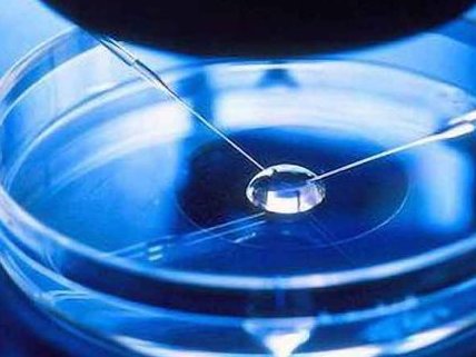 做了结扎手术可以在黔西市试管医院做试管婴儿吗？费用是多少