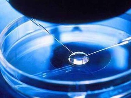 卵巢早衰做俄罗斯试管助孕注意事项（码住收藏）